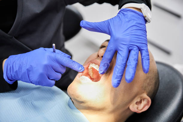 Best Emergency Root Canal Treatment in Robinwood, MD